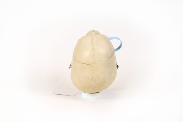 Reknas Pediatric Skull (0170) - Image 5
