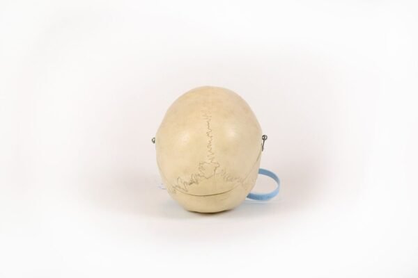 Reknas Pediatric Skull (0170) - Image 3