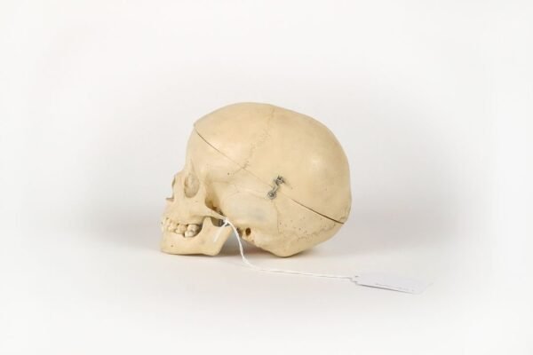 Reknas Pediatric Skull (0170) - Image 4
