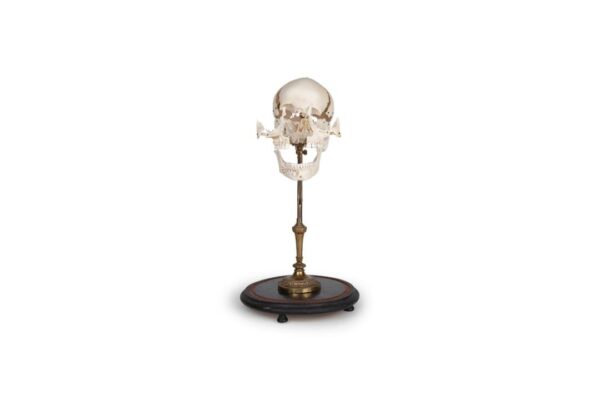 Adolescent exploded skull