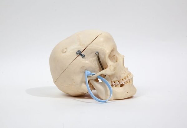 Medical Skull (0242) - Image 3