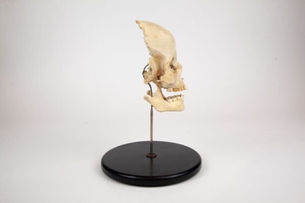 Frontal Bone and Mandible Child Skull Preparation - Image 5