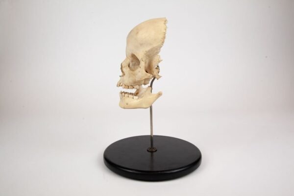 Frontal Bone and Mandible Child Skull Preparation - Image 3