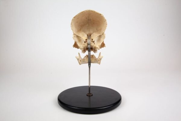 Frontal Bone and Mandible Child Skull Preparation - Image 4