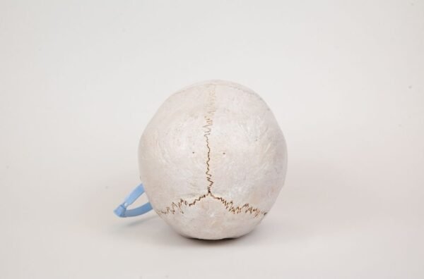 Pediatric Skull with Minor Hydrocephaly (0299) - Image 4