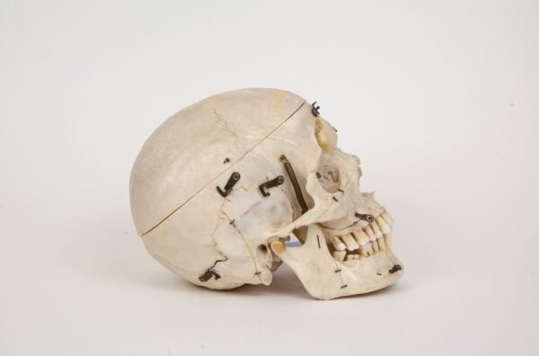 Demonstrative Skull (0298) - Image 3