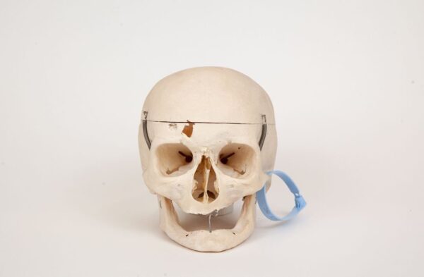 Geriatric Skull (0303)