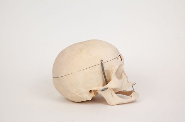Geriatric Skull (0303) - Image 3
