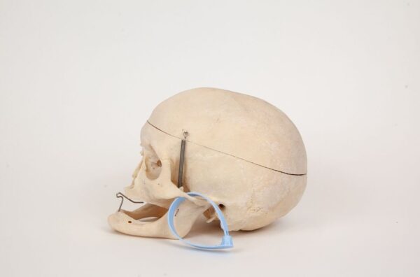 Geriatric Skull (0303) - Image 2