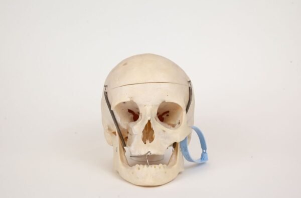 Geriatric Skull (0307)