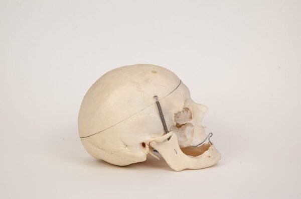 Geriatric Skull (0307) - Image 3