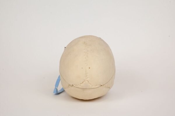 Geriatric Skull (0307) - Image 4