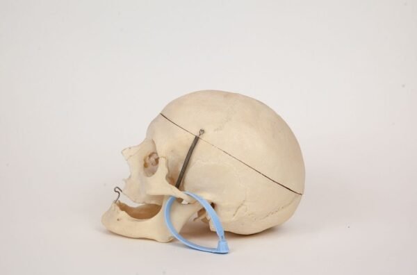 Geriatric Skull (0307) - Image 2