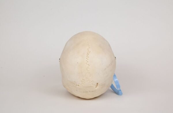 Medical Skull (0314) - Image 4