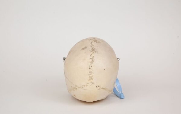 Medical Skull (0329) - Image 4