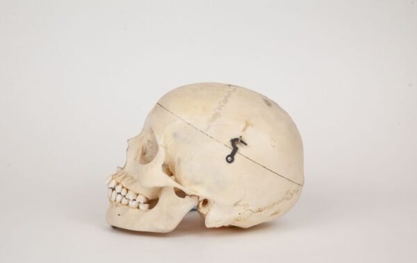 Medical Skull (0329) - Image 2