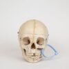 Pediatric Skull (0334)