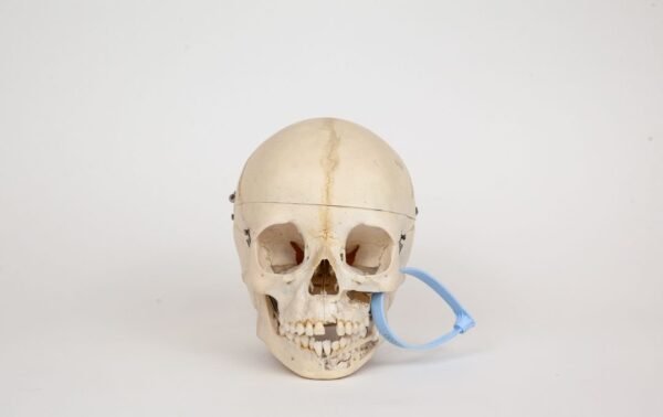 Pediatric Skull (0334)