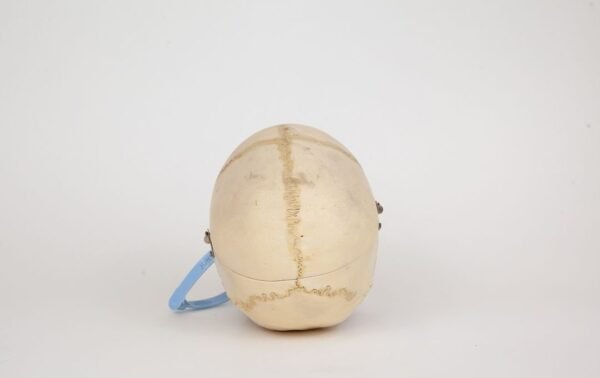 Pediatric Skull (0334) - Image 4