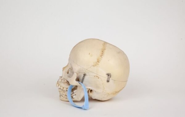 Pediatric Skull (0334) - Image 2