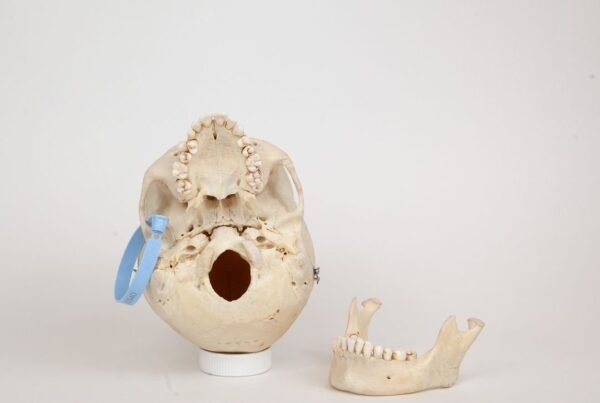Medical Skull (0340) - Image 4