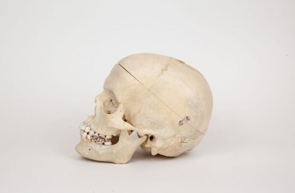 Medical Skull (0342) - Image 3