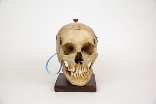 Mounted Medical Skull (0347)