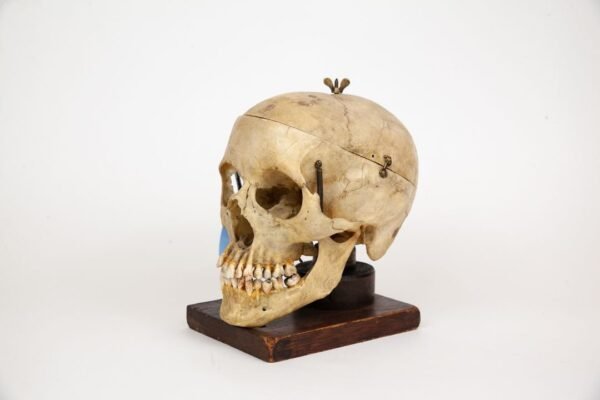 Mounted Medical Skull (0347) - Image 2