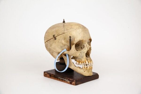 Mounted Medical Skull (0347) - Image 5