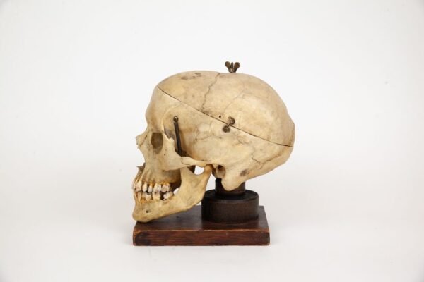 Mounted Medical Skull (0347) - Image 3