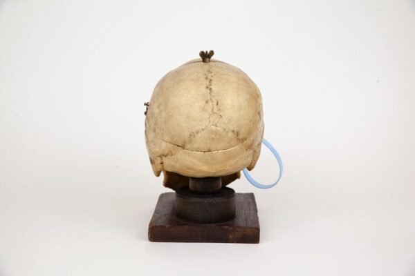 Mounted Medical Skull (0347) - Image 6