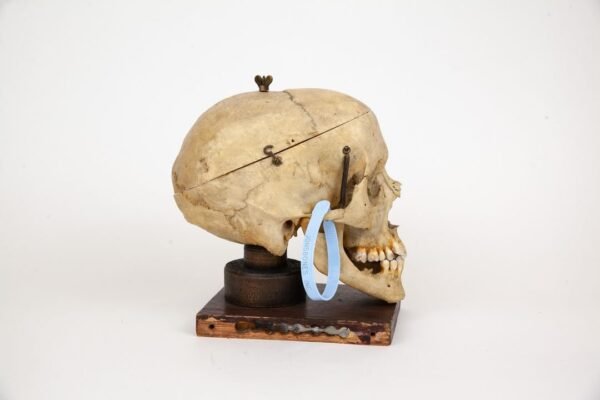 Mounted Medical Skull (0347) - Image 4