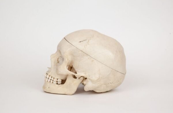 Medical Skull (0348) - Image 3