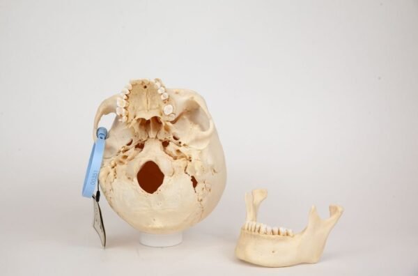 Uncut Medical Skull (0351) - Image 5