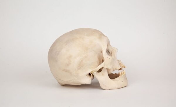 Uncut Medical Skull (0358) - Image 2