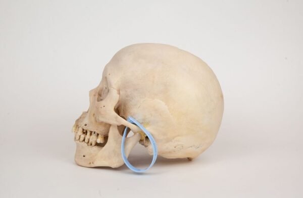 Uncut Medical Skull (0359) - Image 3