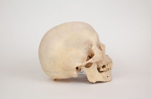 Uncut Medical Skull (0359) - Image 2
