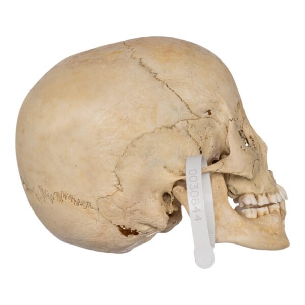 Child Skull
(0633) - Image 2