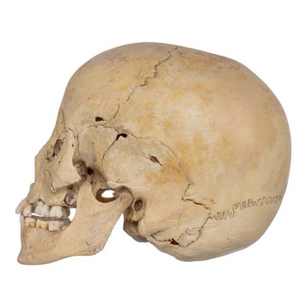 Child Skull
(0633) - Image 3