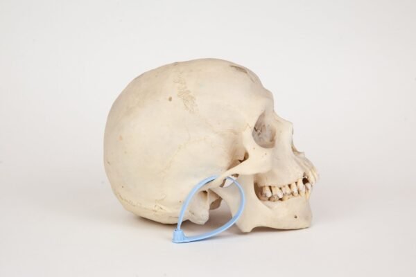 Uncut Medical Skull (0326) - Image 2