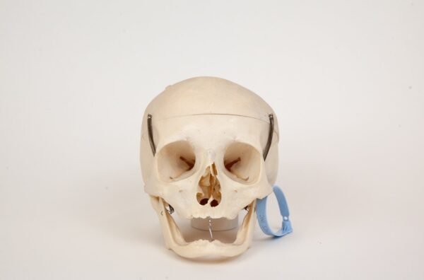 Geriatric Skull (0306)