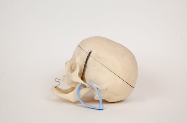 Geriatric Skull (0306) - Image 2