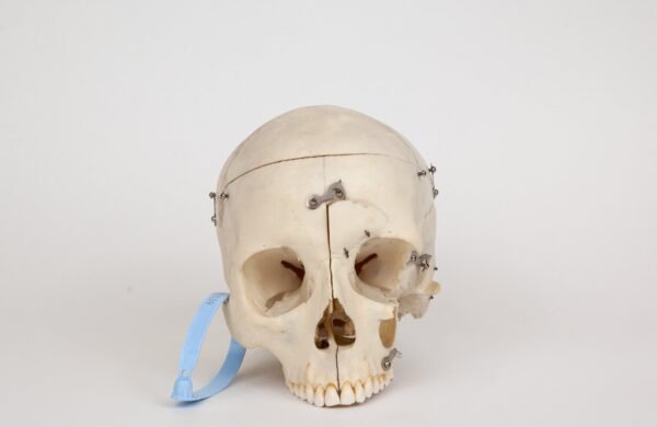 Medical Skull (0239)