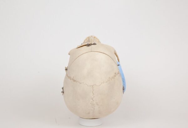 Medical Skull (0239) - Image 4