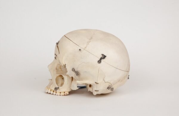 Medical Skull (0239) - Image 3
