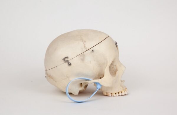 Medical Skull (0239) - Image 2