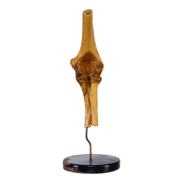 Human Elbow Joint on Stand

(0692) - Image 3