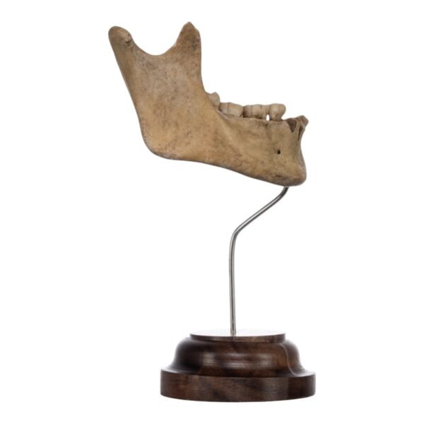 Human Mandible on Stand

(2043) - Image 2