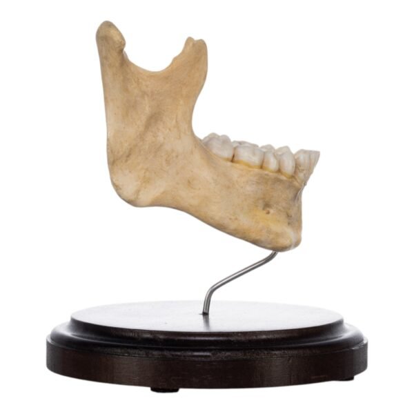 Human Mandible on Stand

(2439) - Image 2