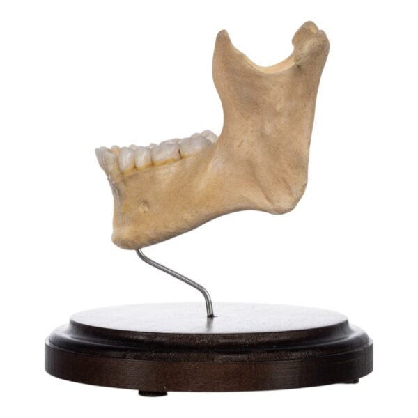 Human Mandible on Stand

(2439) - Image 3